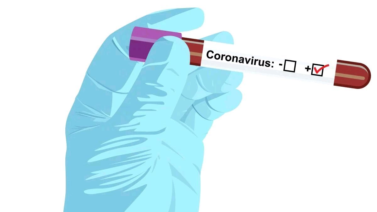 Тест-системи на коронавірус відправлять у три області України