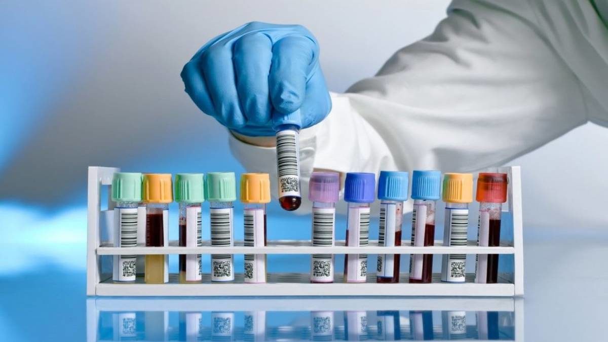 Українці можуть пройти безкоштовний тест на вірусні гепатити